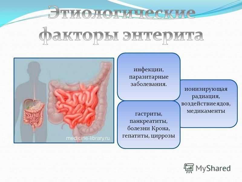 Язвенная болезнь желудка: причины заболевания, методы лечения и профилактики