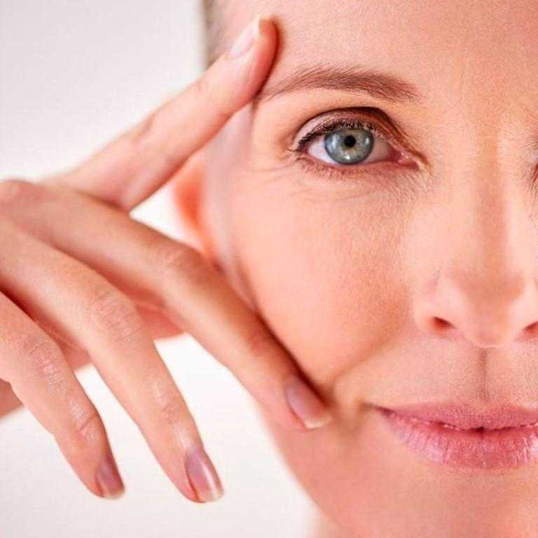 Морщины возле глаз: причины, как избавиться от морщин вокруг глаз