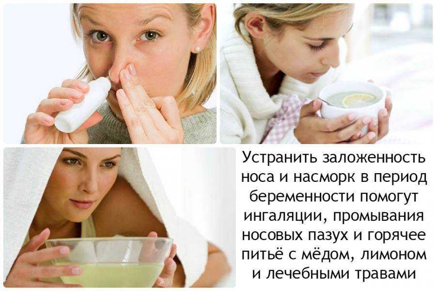 Ринит у беременных