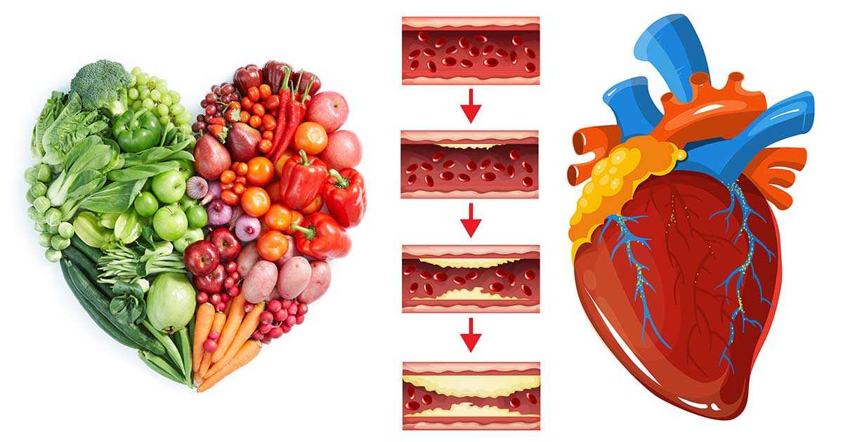 Сахарный диабет и сердечно-сосудистые заболевания