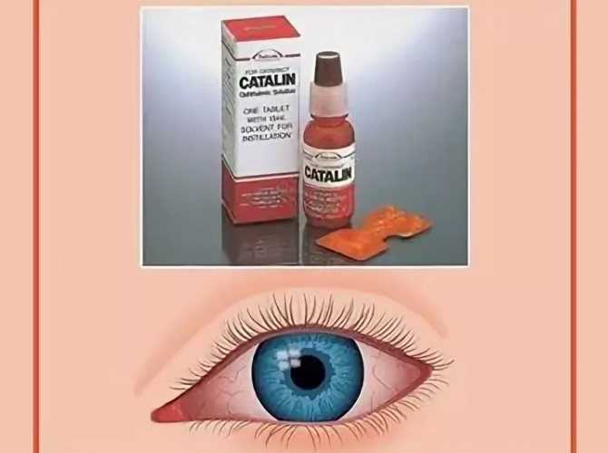Профилактика катаракты, глазные капли для профилактики и лечения катаракты