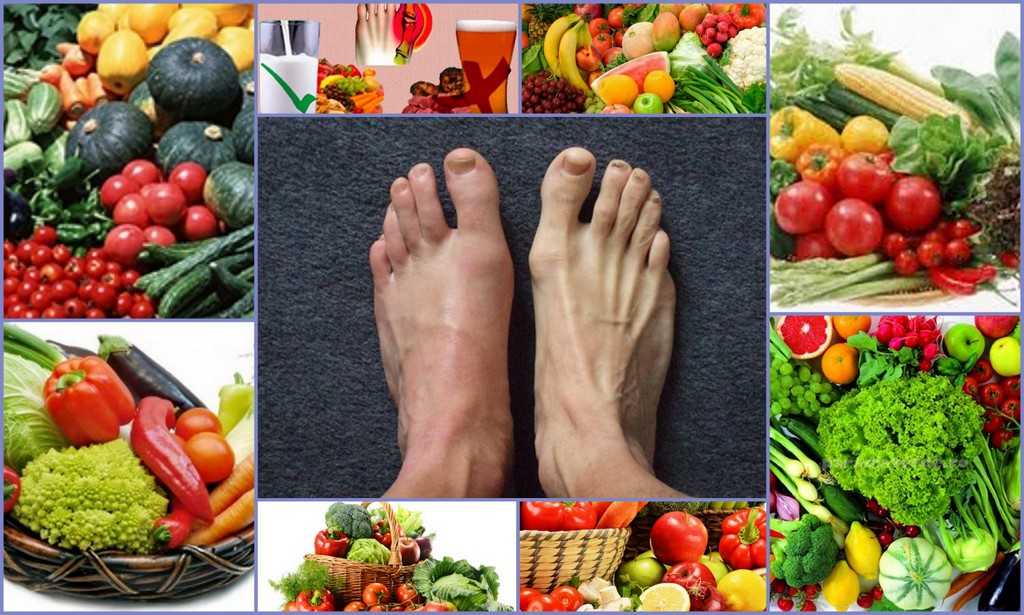 Какие овощи есть при подагре. Подагра фрукты и овощи. Овощи при артрите. Овощи при подагрическом артрите.
