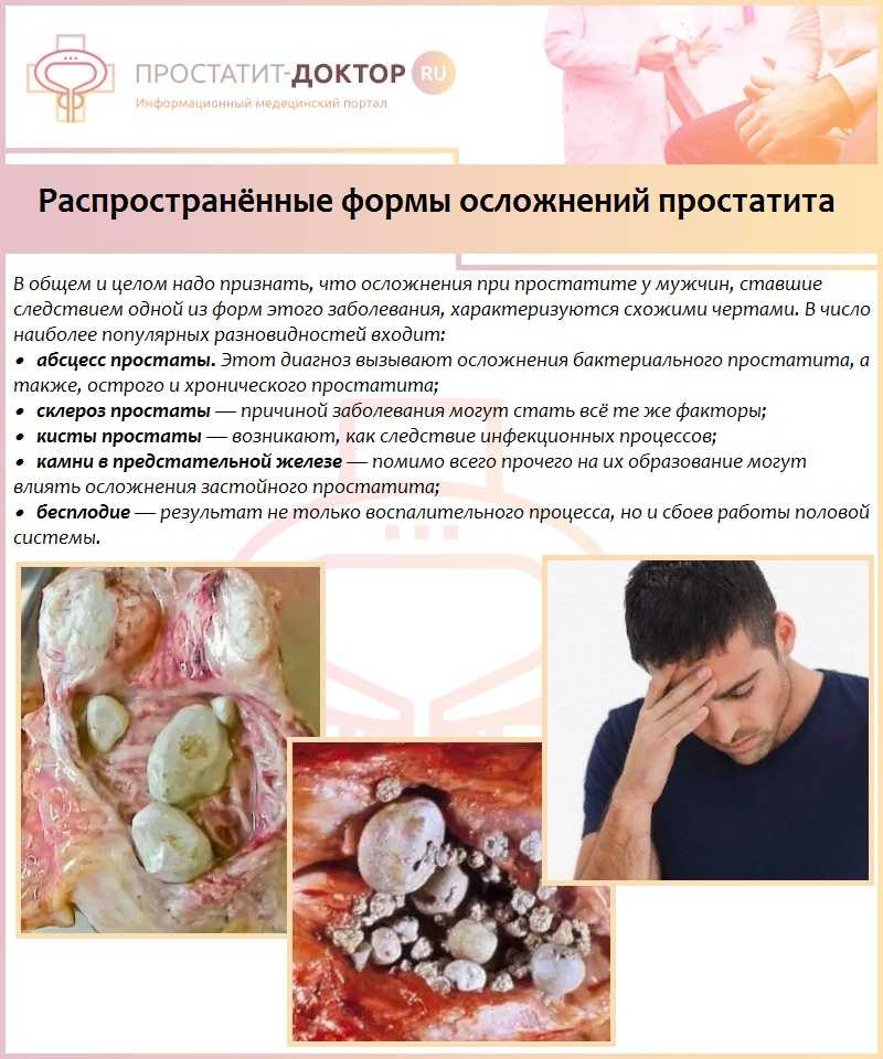 Хронический простатит (воспаление предстательной железы) как причина нарушения семяизвержения